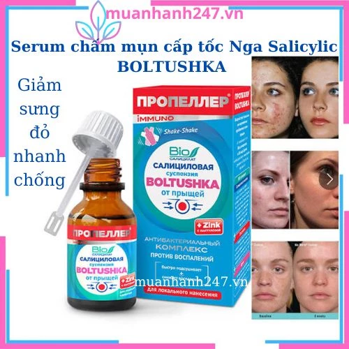 Tinh chất chấm mụn mờ thâm,Serum chấm mụn cấp tốc Nga Salicylic BOLTUSHKA Propeller đánh bay 7 loại mun thâm sau 6 ngày