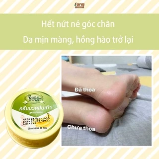 Kem thoa nứt nẻ gót chân hàng nội địa Thái Lan