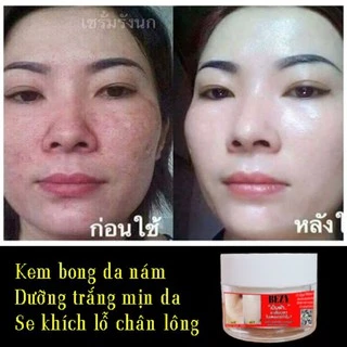 Kem Bong Tái Tạo Trắng Da