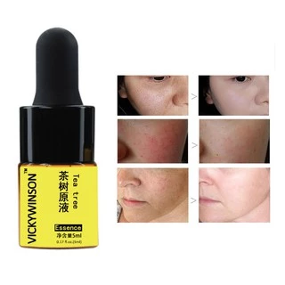 Bộ Dụng Cụ Chăm Sóc Sức Khỏe 5ml / 5ml Chuyên Dụng Chất Lượng Cao