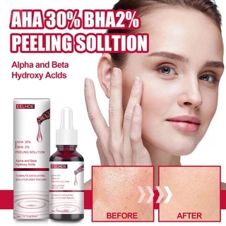 Tinh Chất Axit Hyaluronic 30% + BHA 2% Axit Salicylic Giúp Hỗ trợ giảm mụn Hiệu Quả