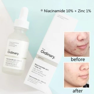 Tinh Chất Giảm Mụn Dưỡng Da The Ordinary Niacinamide 10% + Zin 1%