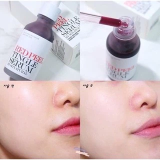 RED PEEL TINGE SERUM SONATURAL - Serum Peel Da Sinh Học Thế Hệ Mới..