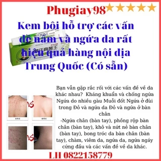 Kem bôi hỗ trợ các vấn đề nấm và ngứa da rất hiệu quả hàng nội địa Trung Quốc ( hàng Có sẵn)