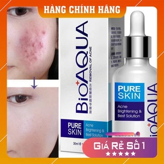 Serum giảm mụn 💕FREESHIP💕 Serum Làm Sạch Mụn Trắng Da Dưỡng Ẩm Cấp Tốc Bioaqua Pure Skin 30ml