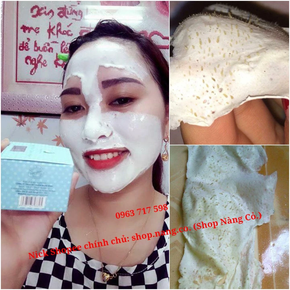 Gel Hút Mụn Bạc Hà, Mặt nạ Gel lột mụn Ngân Bình chính hãng gel lột mụn cám, mụn đầu đen, da chết, lông tơ, bụi bẩn