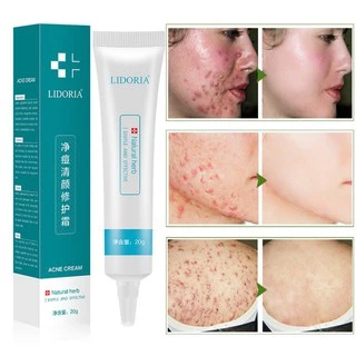 LIDORIA 20g Moisturizer Hydrating Remove  Face Cream Shrinking Pores Face Gel Firming Skin Facial Accessory