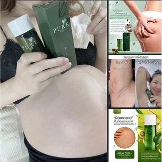 Dầu rạn da cho bà bầu Thiên Nhiên Thái Lan - Ngăn ngừa và làm giảm rạn da khi mang thai 100ml