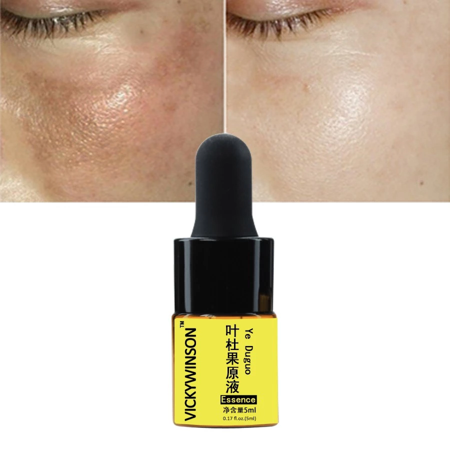 Ye Duguo Tinh Chất 5ml Repair Eye Serum Làm Trắng Da Dưỡng Ẩm Chống Lão Hóa Nếp Nhăn Loại Bỏ quầng thâm Chăm Sóc Mắt Serum