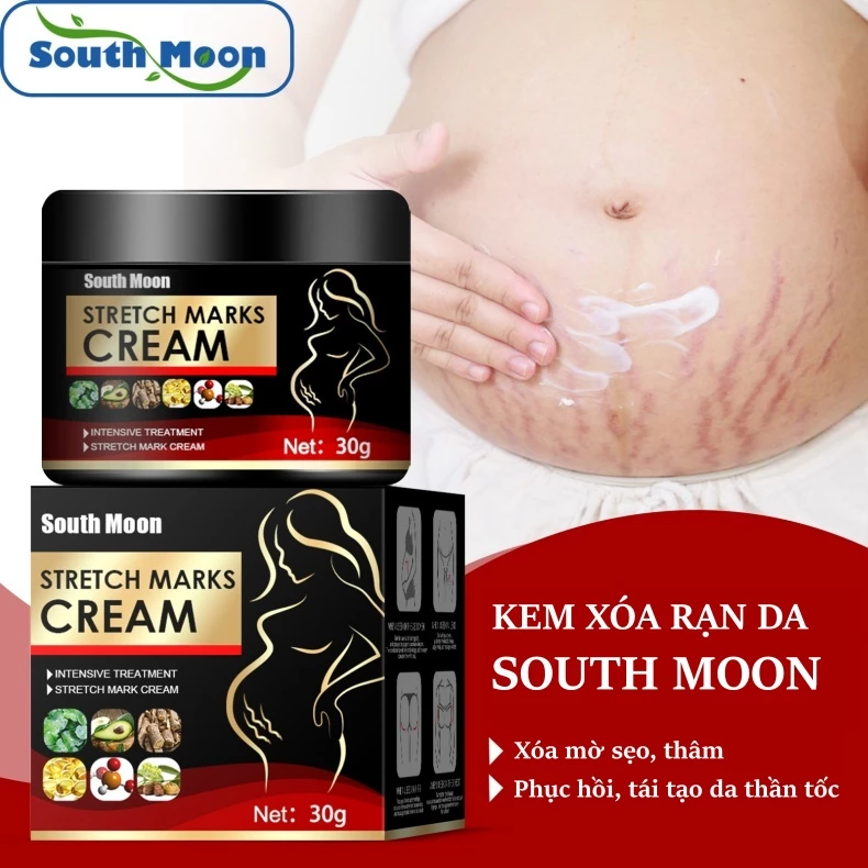 Kem rạn da, mờ thâm, mờ sẹo cho mẹ bầu South Moon Mỹ