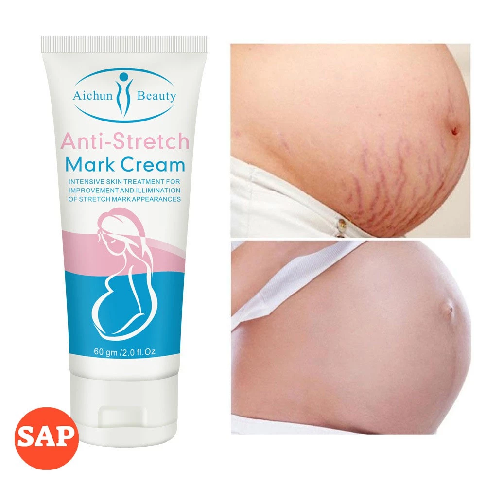 Kem làm mờ rạn da, kem tái tạo da hiệu quả cho bà bầu Anti-stretch Marks Cream - mờ sẹo, giảm thâm, giảm nhăn hiệu quả