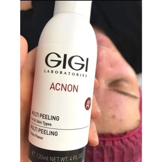 Tinh Chất Peel Cho Mọi Loại Da GiGi Acnon Multi Peeling 120 ml