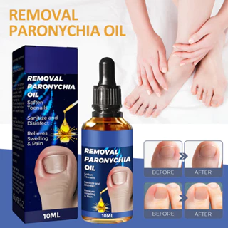 Tinh Dầu Paronychia 10ML Hỗ Trợ Giảm Bệnh Nấm Móng Và Móng Chân