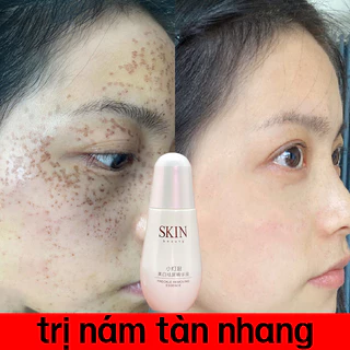 kem nám tàn nhang 50ML Serum trắng da và loại bỏ đốm nám tàn nhang Làm mờ vết thâm hiệu quả Chống lão hóa Làm trắng và sáng