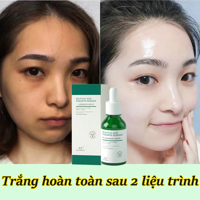 Serum trắng da Serum se khít lỗ chân lông 30ML Se khít lỗ chân lông lột mụn đầu đen  vết mụn dưỡng ẩm