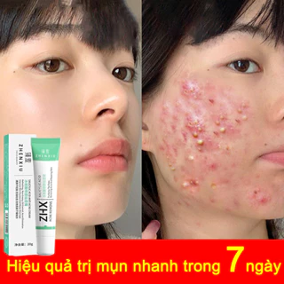 Nóng Bán Kem Mụn Nhanh Chóng Loại Bỏ Mụn Bọc, Kem Bôi Mụn, Phục Hồi Vết Tích Mụn Và Chống Viêm Mụn, Làm Mờ Thâm Mụn