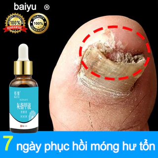 ⭐CHÍNH HÃNG⭐ Kem nấm móng móng tay chăm sóc Nấm móng tay 20ml Cải thiện vết nứt móng tay giảm nhiễm nấm kích thích mọc móng