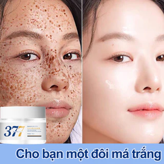 kem trắng da mặt 50ml kem nám tàn nhang Kem trắng da và xóa tàn nhang Hiệu quả làm mờ thâm nám tàn nhan