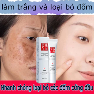 Kem trắng da và xóa tàn nhang Kem nám tàn nhang 20g kem dưỡng trắng da mặt Hiệu quả làm mờ thâm nám tàn nhan se khít lỗ chân lông