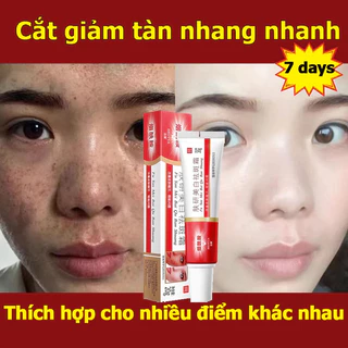 Kem tàn nhang làm trắng da 20g Làm trắng tức thì, loại bỏ tàn nhang, nám sạm，nám da,các đốm đồi mồi nhanh chóng,Dưỡng ẩm và làm sáng tông màu da