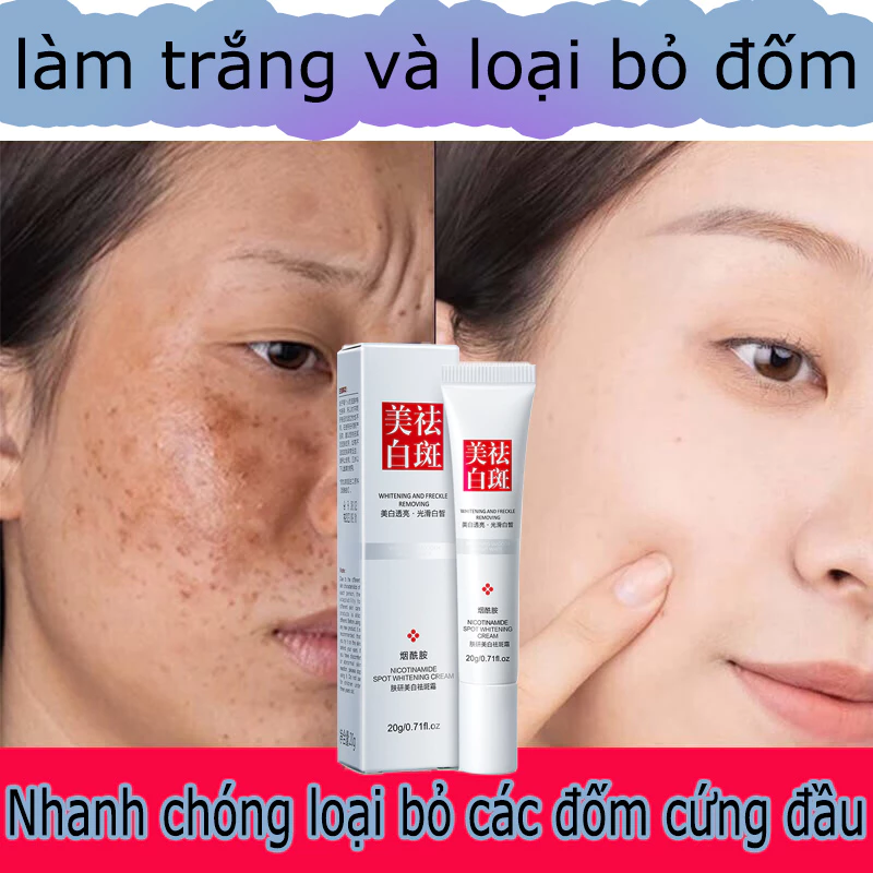 Kem bôi trắng da mặt kem tẩy trắng da cấp tốc xóa vết thâm nám,vết chân chim, làm mờ hắc tố, làm trắng da, kem trị nám tàn nhang