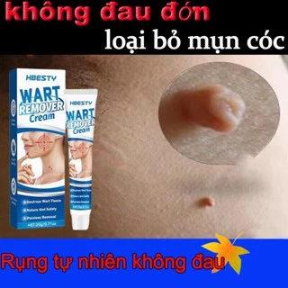 mụn cóc kem loại bỏ mụn cóc 20g xóa nốt ruồi mụn cóc mụn thịt sạch mụn thịt thừa mụn thịt, tàn nhang