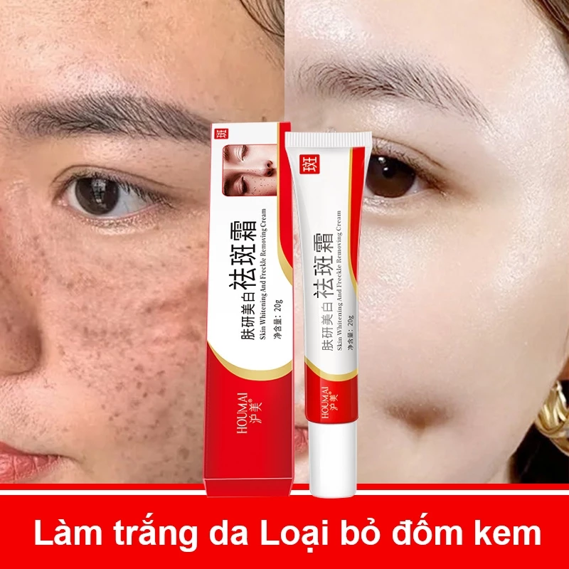 Loại bỏ tàn nhang, kem làm trắng da, sắc tố làm sáng da, phụ nữ, loại bỏ tàn nhang 20g Màu da không đều Chăm sóc da