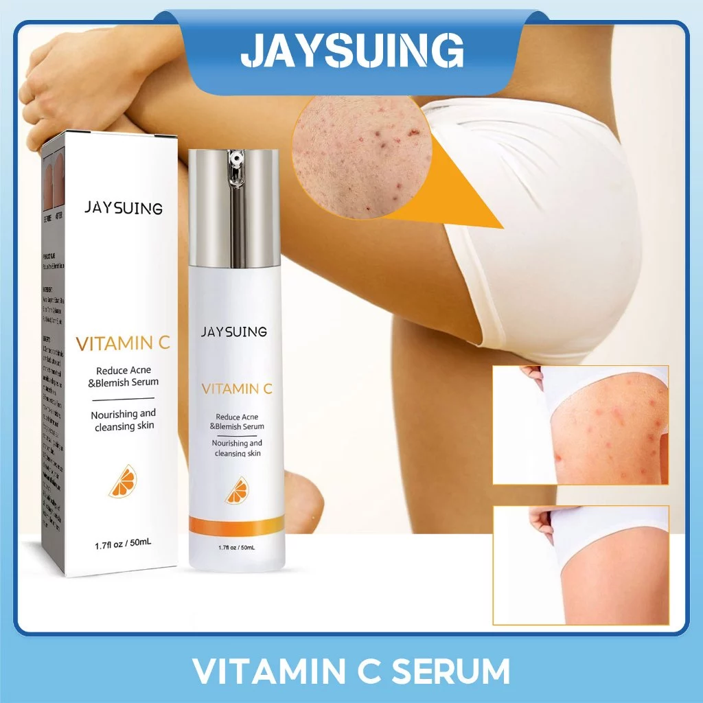 Jaysuing Vitamin C Giảm Mụn Huyết Thanh 50ml Điều Hỗ trợ giảm mụn Serum Làm Sạch Mụn Mụn Mụn Điểm Thu Nhỏ Lỗ Chân Lông Kiểm Soát Dầu Làm Sáng Làm Trắng Da Chống Mụn Tinh Chất