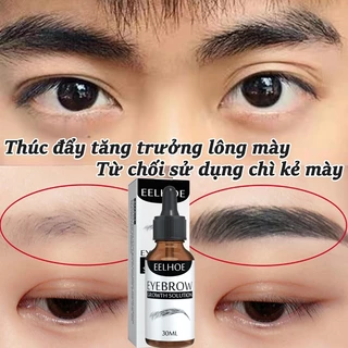 ⚡ GÌ CŨNG RẺ ⚡Serum dưỡng mày Tinh chất tăng trưởng lông mày Serum Kích Thích Mọc Râu Mọc Lông Mi Mọc Lông Mày 30ml giúp lông mày dày đẹp tự nhiên sau