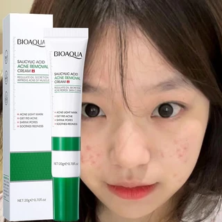 Kem loại bỏ mụn axit salicylic  nhanh chóng loại bỏ mụn bọc  Giảm Mụn Đầu Đen Và Mụn Trứng Cá  20g