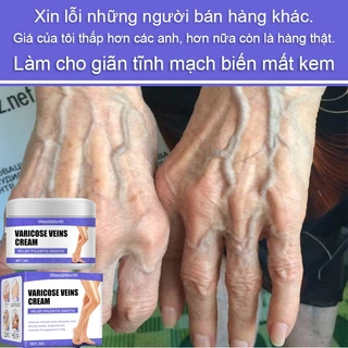 Điều trị đặc biệt cho giãn tĩnh mạch Kem dưỡng tĩnh mạch giãn tĩnh mạch Kem điều trị tĩnh mạch, giúp tuần hoàn tĩnh mạch phục hồi hiệu quả các mạch máu sưng ở cánh tay và chân, r