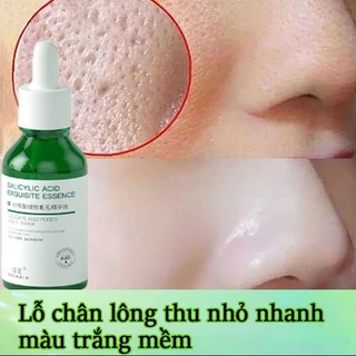 Serum se khít lỗ chân lông se khít lỗ chân lông 30ml lột mụn đầu đen trắng da mặt cấp ẩm cho da