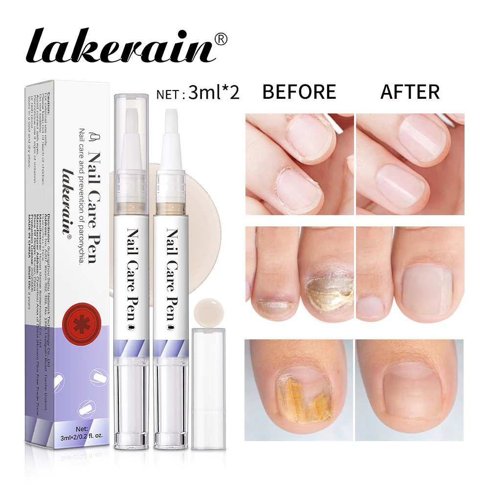 Bút chăm sóc móng tay Lakerain, Nail Art Cuticle Oil Treatment Bút làm móng tay, Nuôi dưỡng và dưỡng ẩm Móng tay cần thiết, Cải thiện sự xuất hiện của móng tay, Thúc đẩy tăng trưởng móng tay Treament