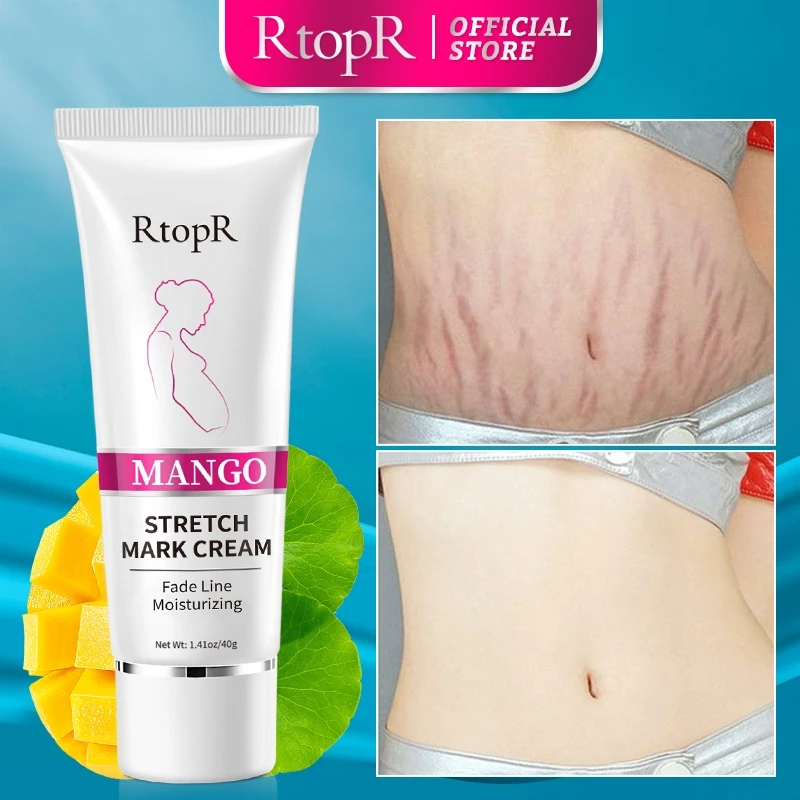 RtopR Xoài Xóa Sẹo Mang Thai Kem Rạn Da Kem Làm Săn Chắc Cơ Thể 40g RtopR Mango Remove Pregnancy Stretch Marks Maternity Cream