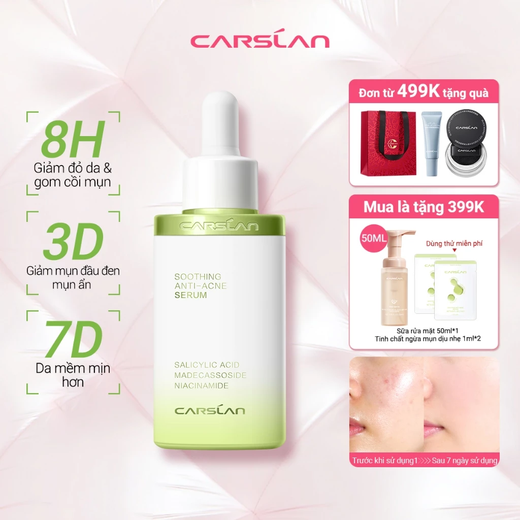 Serum Hỗ trợ giảm mụn Carslan Soothing 30ml