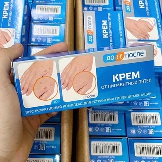 Kem đồi mồi tay chân Kpem Nga - Kem giảm đồi mồi tay chân KPEM