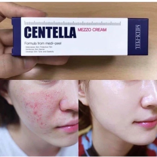 Kem dưỡng MEDIPEEL cho da mụn rau má Centella Mezzo Cream giảm mụn mờ thâm làm dịu da medi peel