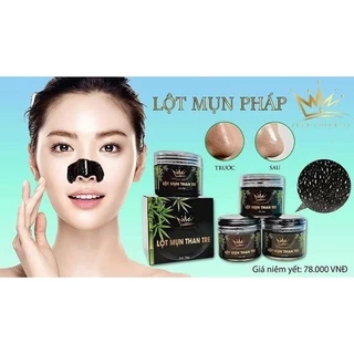 Gel Lột Mụn Than Tre Pháp Cosmetic