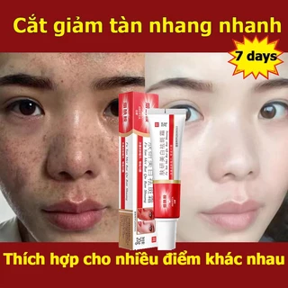 Dark Spot Corrector Cream Kem làm trắng tàn nhang Loại bỏ mạnh mẽ Nám Melanin Vết thâm Sắc tố Làm sáng Dưỡng ẩm Chăm sóc da 20g