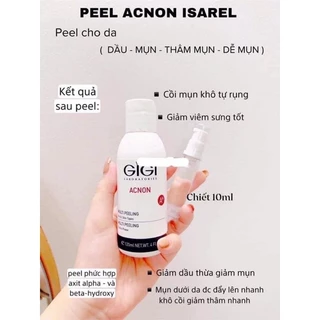 Peel xử lý, loại bỏ mụn - GiGi Acnon Multi Peeling