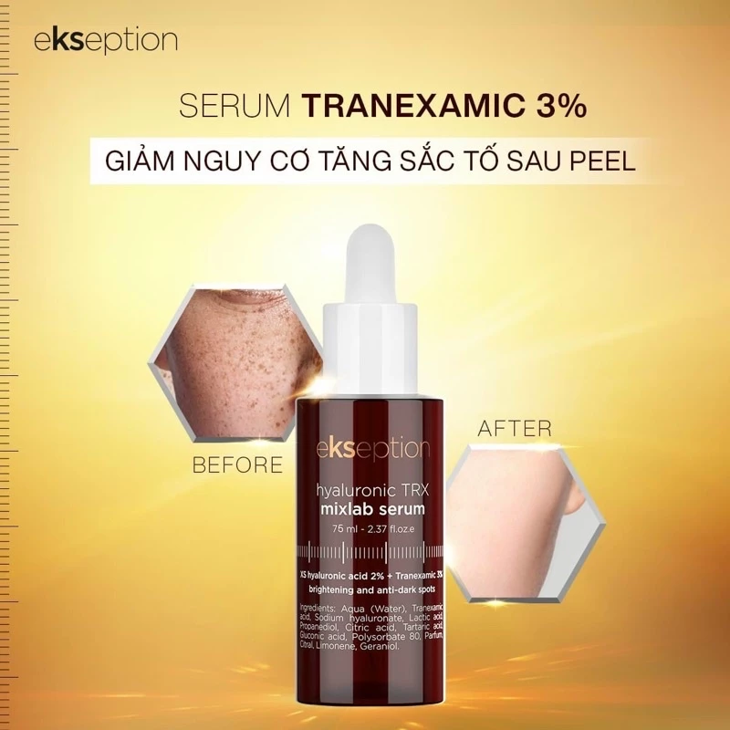 [75ML] Serum sáng da, cải thiện sạm nám Ekseption Hyaluronic TRX