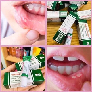 Tuýp Kem Bôi Nhiệt Miệng Trinolone Oral Paste Thái Lan