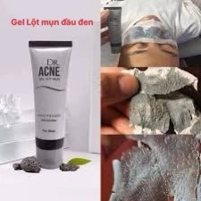 Gel Lột Mụn Đầu Đen- DR.ACNE - Hút sạch mụn cám, mụn đầu đen. Thải độc chì- Sáng da