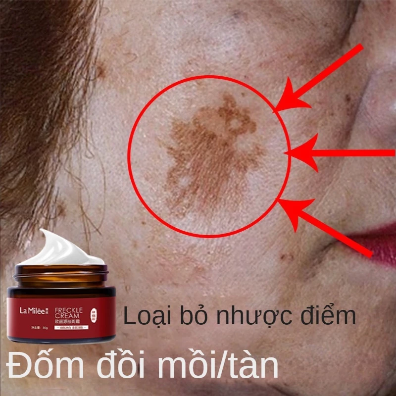 Kem Làm Trắng Da Loại Bỏ Tàn Nhang Loại Bỏ Melanin Và Làm Dịu Da Hiệu Quả