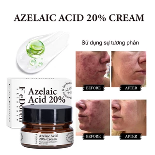 【💯Hàng thật】Kem dưỡng da mặt Azelaic Acid 20% Cream 30g