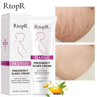 【💯Hàng thật】Kem dưỡng trị rạn da RtopR mango pregnancy scars cream 40g Dự phòng cho phụ nữ có thai, khắc phục rạn da