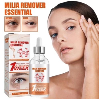 South Moon Milia Remover Essential Oil Eyes Fat Granules Removal Serum Anti-Aging Moisturizing Anti-Puffiness Eye Skin Care