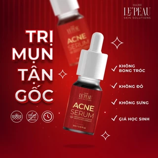 (Giá tốt) Giảm Mụn Thâm Rỗ Lepeau Acne Serum 5ml, Kem Bôi Mụn Trắng Sáng Khô Còi Mụn, Thâm Sau Mụn