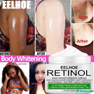 [Trong kho] Eelhoe Retinol Kem làm trắng để loại bỏ melanin sáng kem cổ tích da ban đầu cho các bộ phận tư nhân/cơ thể/nách/cổ dikalu