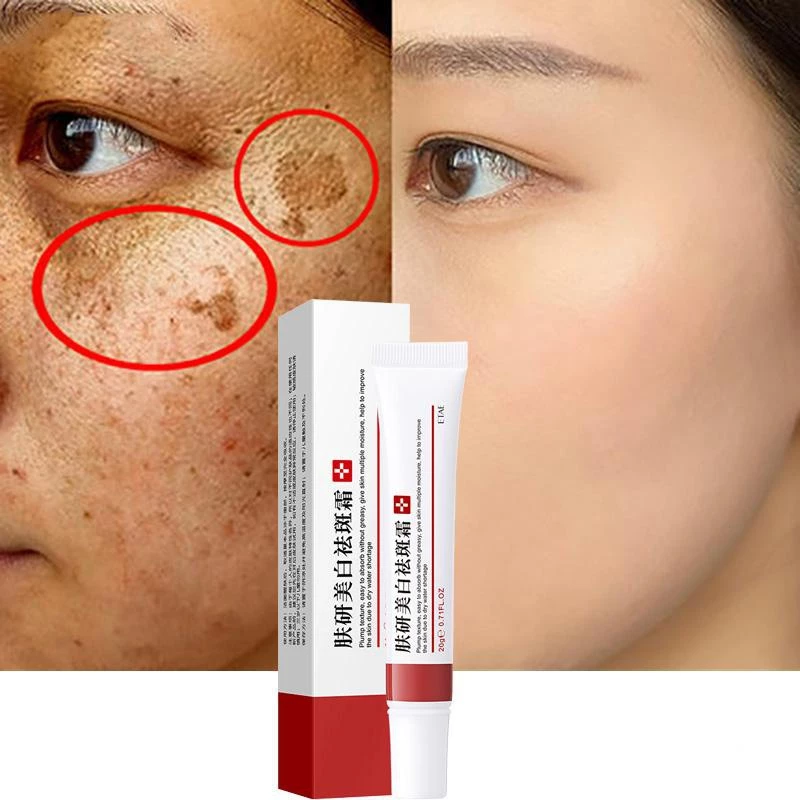 Kem Dưỡng Trắng Da Làm Mờ Vết Thâm / Melanin / Chống Lão Hóa Hiệu Quả